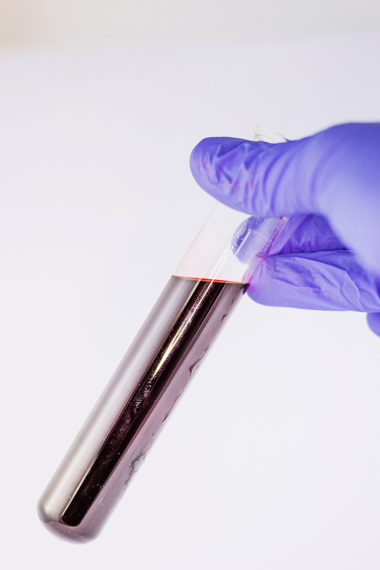 Blood and biohazard safety